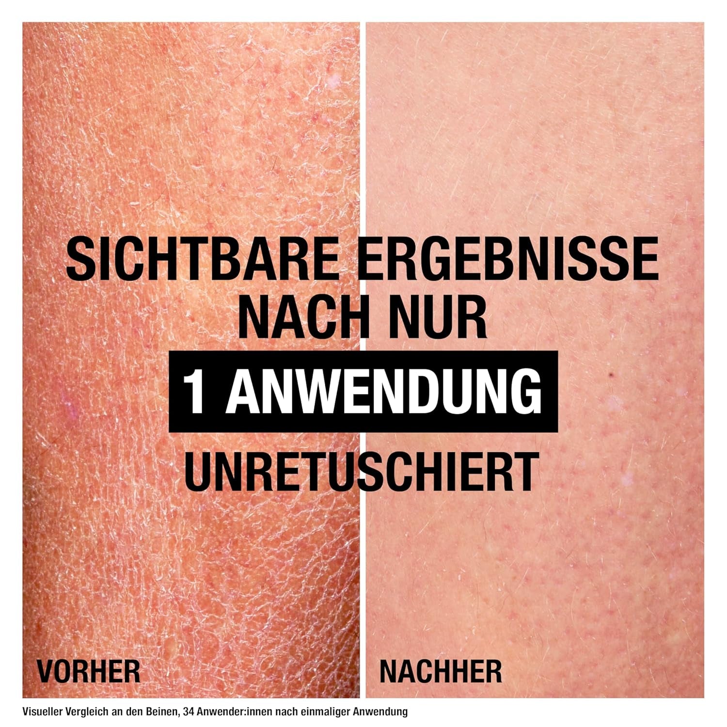 Neutrogena Deep Moisture Bodylotion Sensitive Parfümfreie Pflege 250Ml